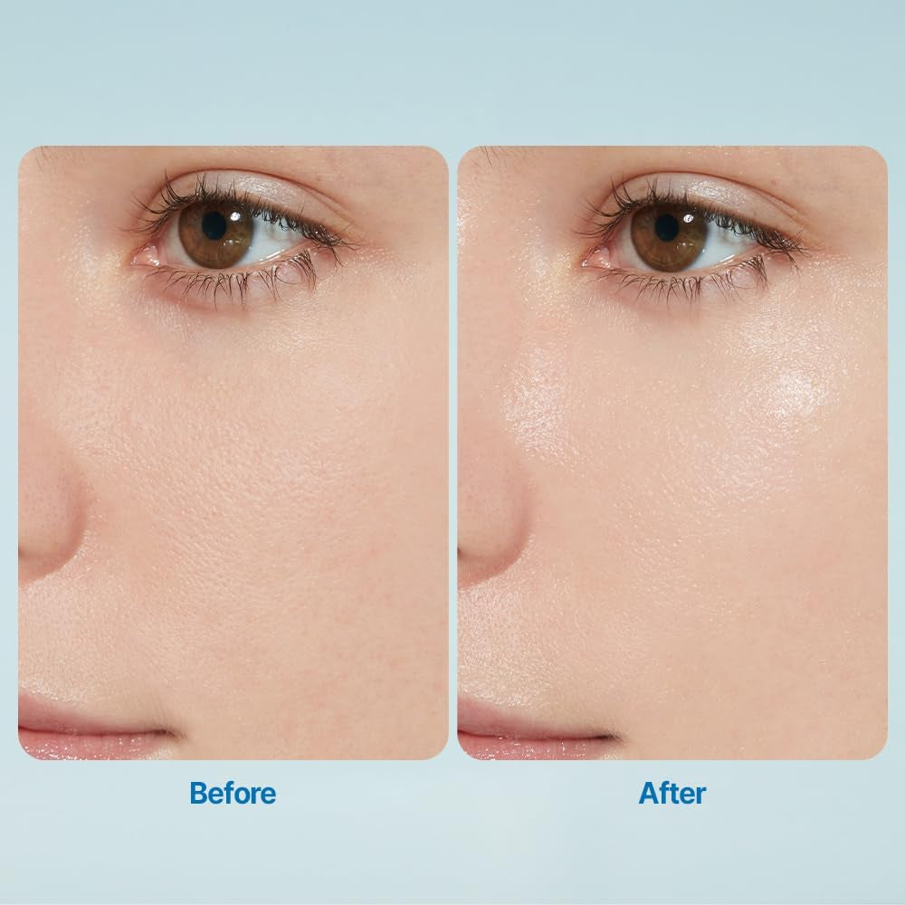 Soonjung 2X Intensive Cream for Barrier Repair, Rich Moist, Madecassoside & Panthenol for Soothing, Face Moisturizer for Sensitive Skin, Ph Balanced, Hypoallergenic, Korean Skin Care,2.02 Fl Oz